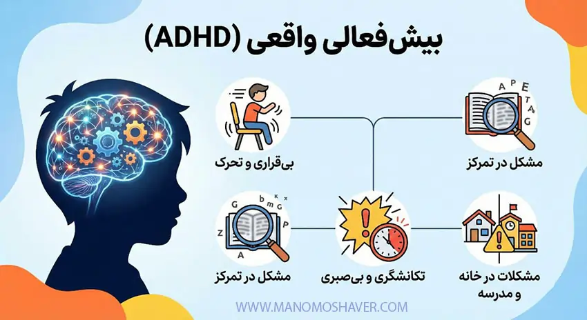 بیش فعالی واقعی